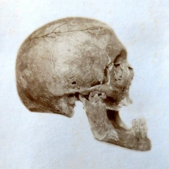 Schädel von Joseph Mohr